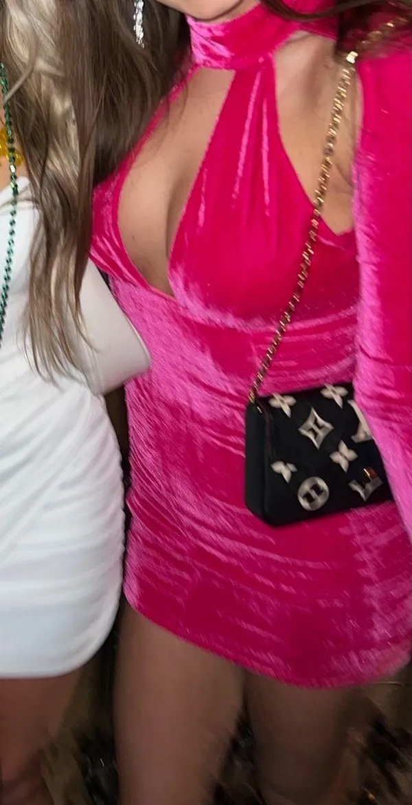 Lovers + Friends Dress - Image 3
