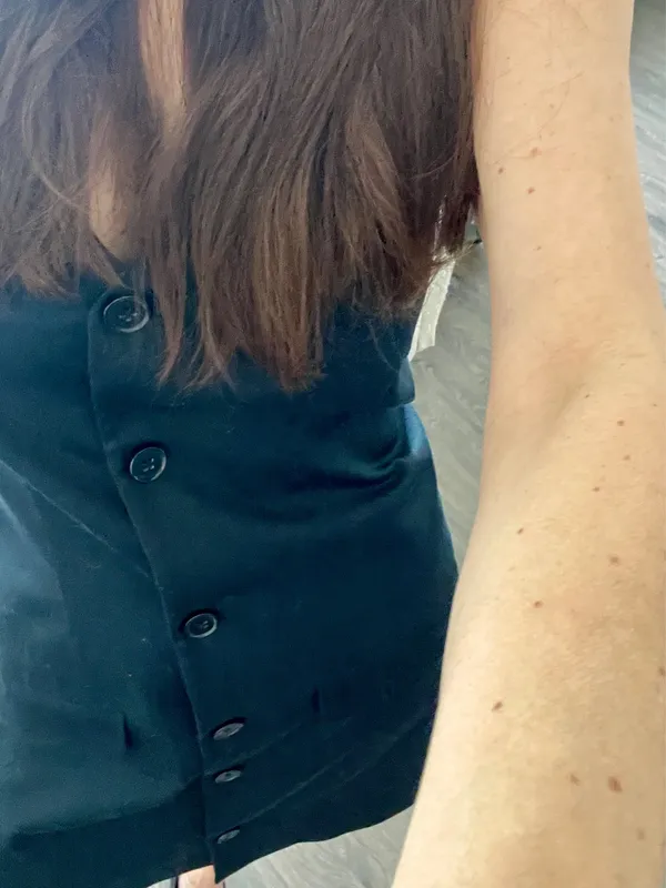 Abercrombie Mara Dress - Image 3