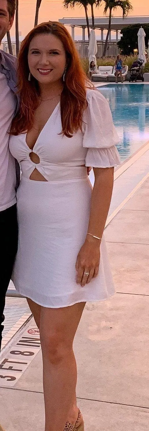J.O.A. White Cut Out Mini Dress - Image 3