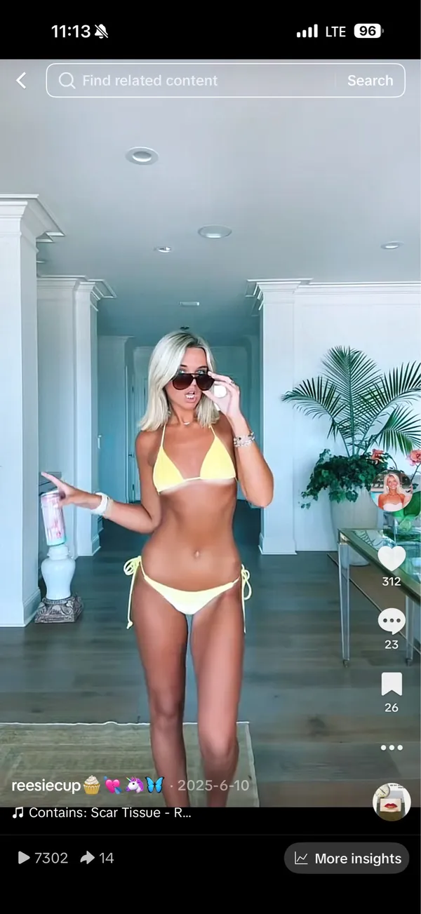 Triangl Bikini Set - Image 2