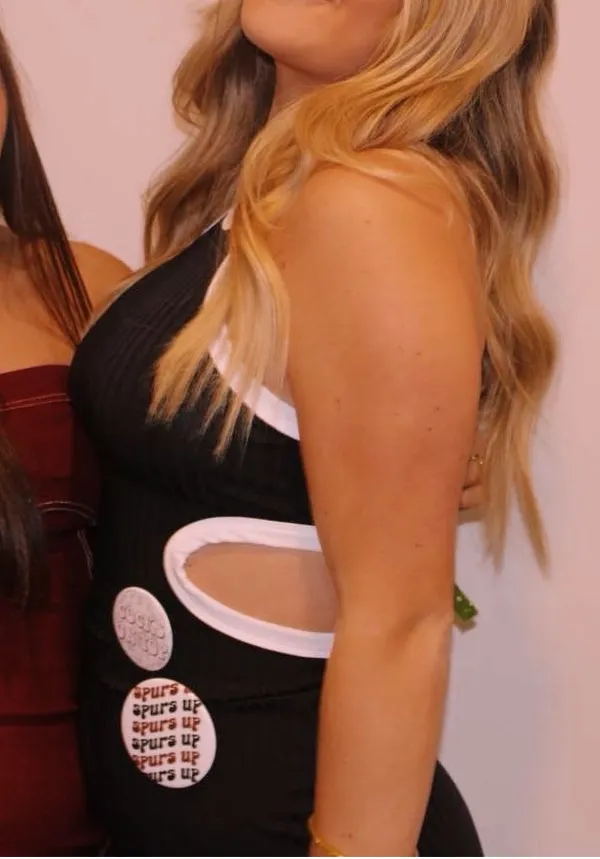 Black and white midi cutout dress - Image 3