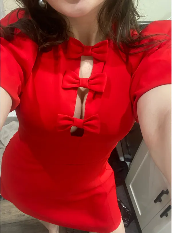 VICI mini dress - Image 2